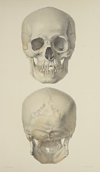 The Necropolis of Ancon Vol. 3 - Slightly deformed Skull [I] (1880)