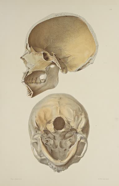 The Necropolis of Ancon Vol. 3 - Slightly deformed Skull [III] (1880)