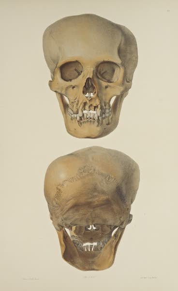 The Necropolis of Ancon Vol. 3 - Greatly deformed Skull [I] (1880)