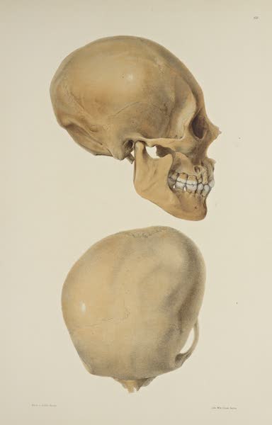The Necropolis of Ancon Vol. 3 - Greatly deformed Skull [II] (1880)