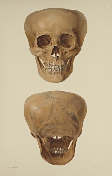 The Necropolis of Ancon Vol. 3 - Greatly deformed Skull [IV] (1880)