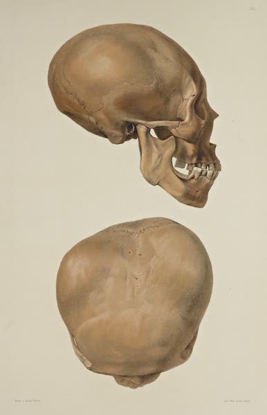 The Necropolis of Ancon Vol. 3 - Greatly deformed Skull [V] (1880)
